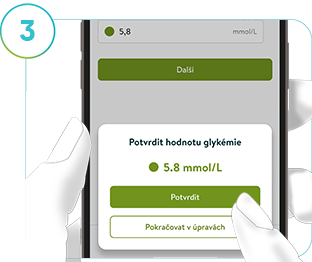 Snímek obrazovky „Kalibrace“ modulu Přehledy glukózy mySugr, který podrobně popisuje postup kalibrace senzoru CGM.