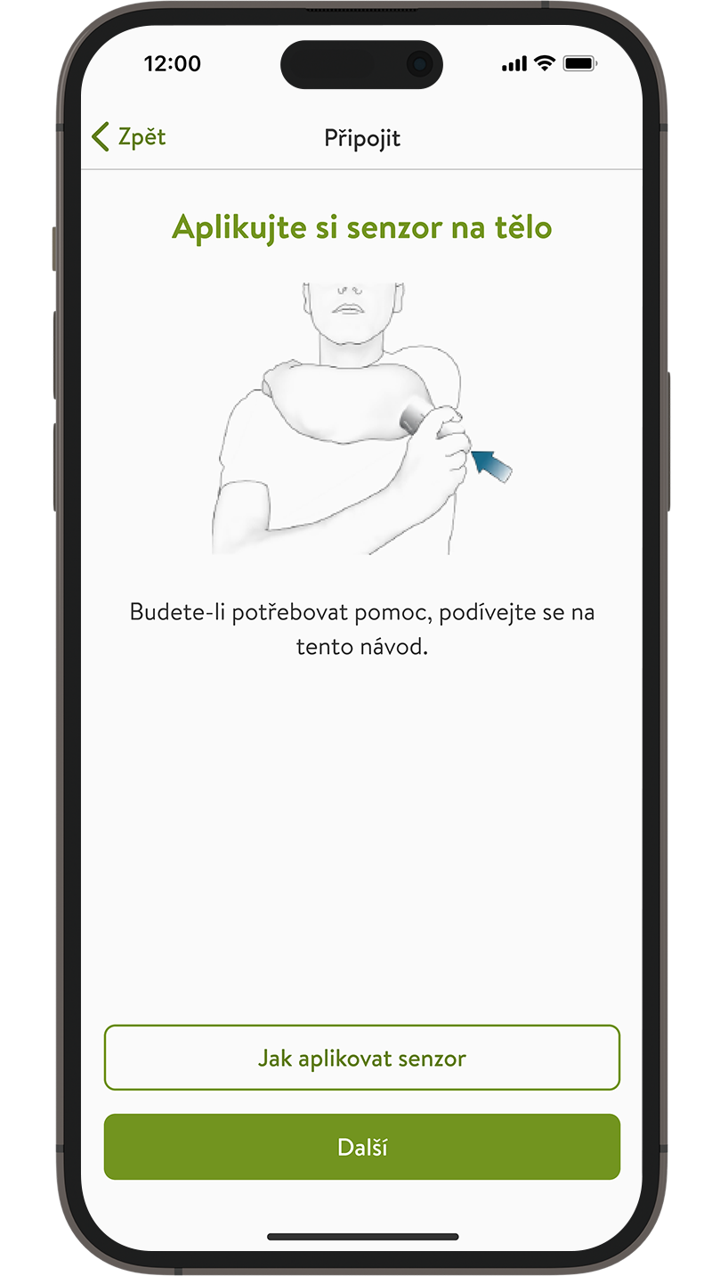Obrazovka „Aplikace a párování senzoru“ v aplikaci mySugr